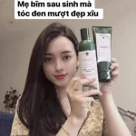 Đánh giá combo bộ dầu gội xả Weilaiya mọc tóc chiết xuất gừng xả