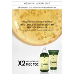 Đánh giá combo Dầu Gội Xả Gừng Weilaiya Màu Xanh Zingiber Detox X2 Ginger Essence Giúp Tóc Bóng Khỏe Giảm Gãy Rụng