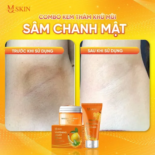 MQ Skin Sâm Chanh Mật, bộ kem tẩy lông và kem thâm nách 50g & 10g