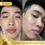 Combo Serum 80ml và Bột Rửa Mặt Sâm Vàng MQ Skin