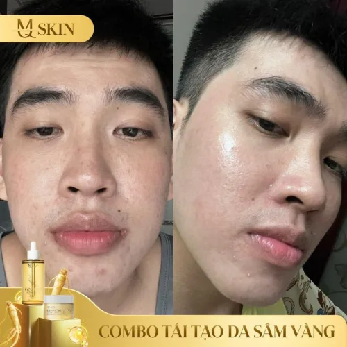 Combo Serum 80ml và Bột Rửa Mặt Sâm Vàng MQ Skin