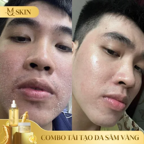 Combo Serum 80ml và Bột Rửa Mặt Sâm Vàng MQ Skin