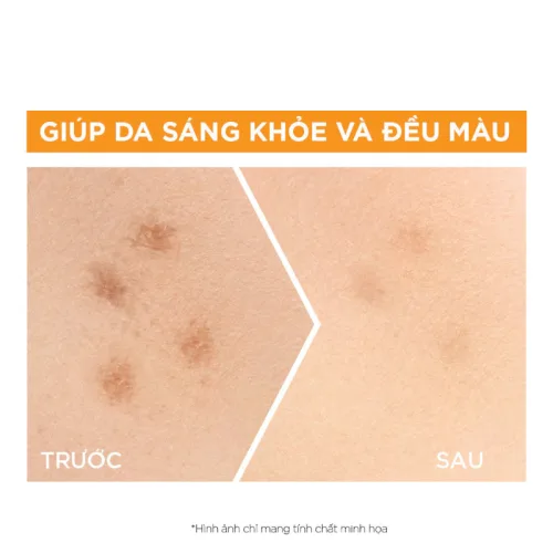 Serum Garnier Dưỡng Sáng Da Skin Naturals Bright Complete 30x Vitamin C Booster Serum 30ml
