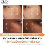 Tinh Chất Niacinamide + Vitamin C Olay Lumious 30ml