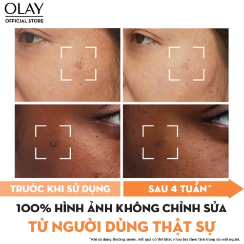 Tinh Chất Niacinamide + Vitamin C Olay Lumious 30ml