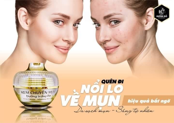 Kem Face Chuyên Mụn Trắng Da Huỳnh Đỗ