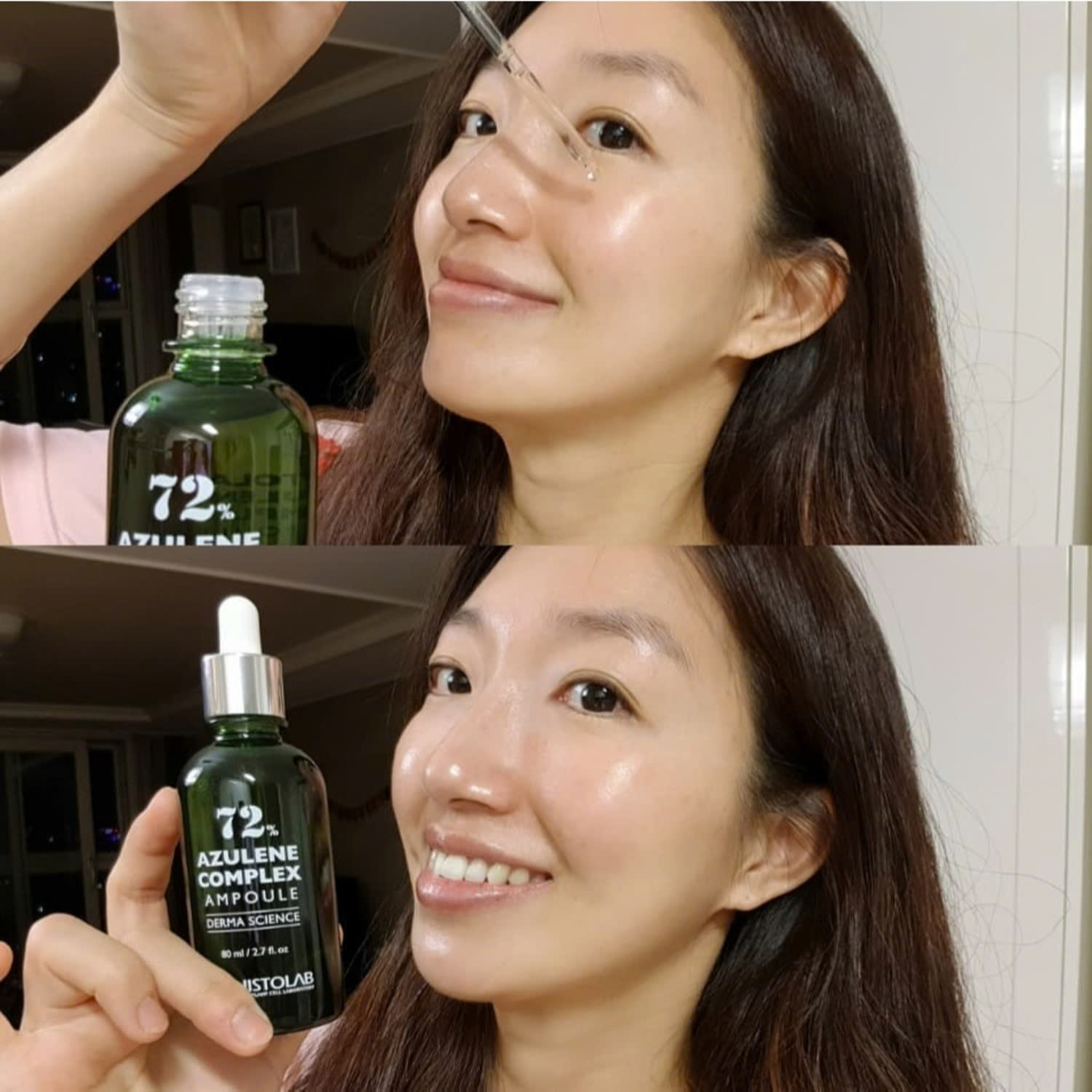 Bạn Vẫn đang lăn tăn lựa chọn serum dưỡng cho da mụn Chọn liền Tinh Chất Histolab 72% Azulene Complex Ampoule 50ml đi thôi