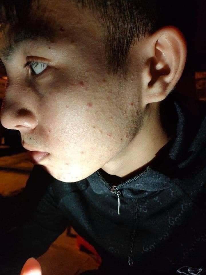 ✨✨Hồi sinh nhan sắc với thay da nhân sâm MQ Skin