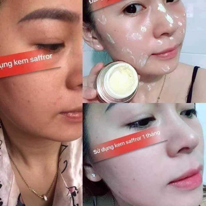 Kem Face Trị Nám Dưỡng Trắng Da Saffron Napoli Hải Âu Việt