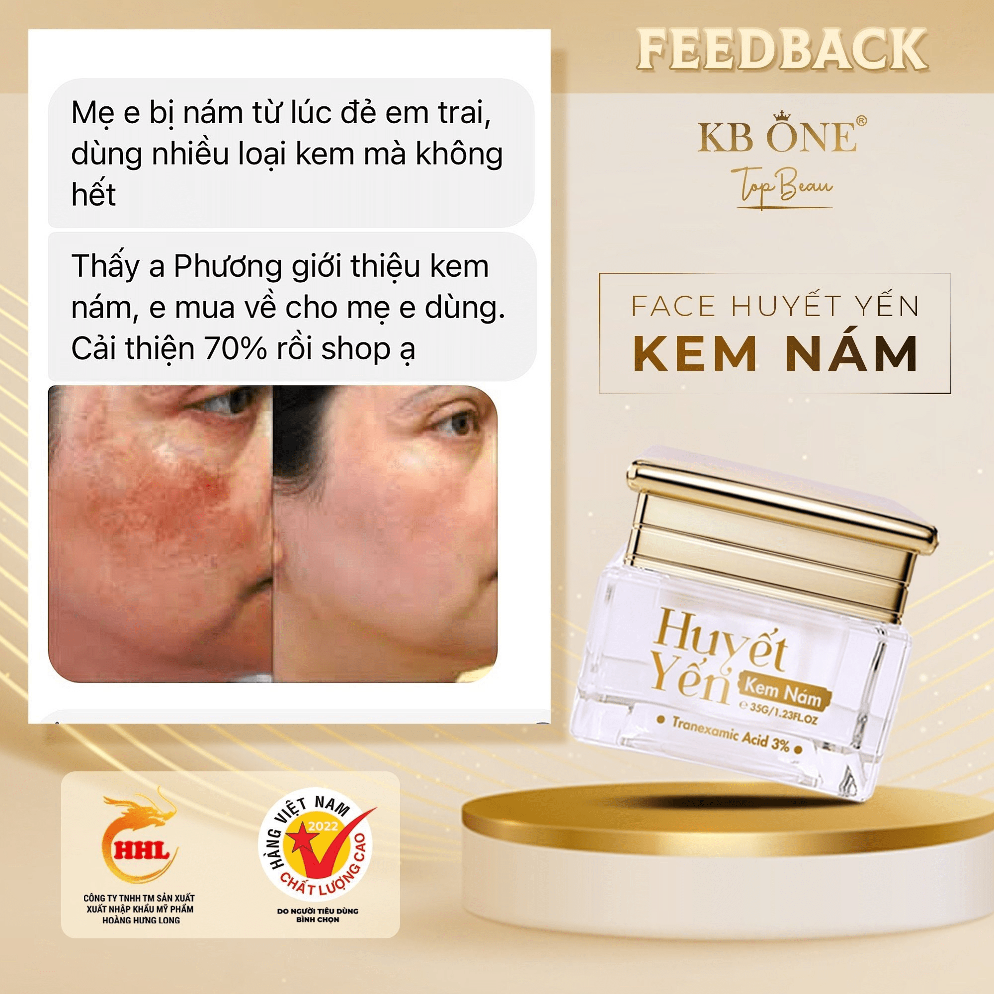 Đánh tan nỗi lo về những đốm nám tàn nhang với bộ nám huyết yến KBone