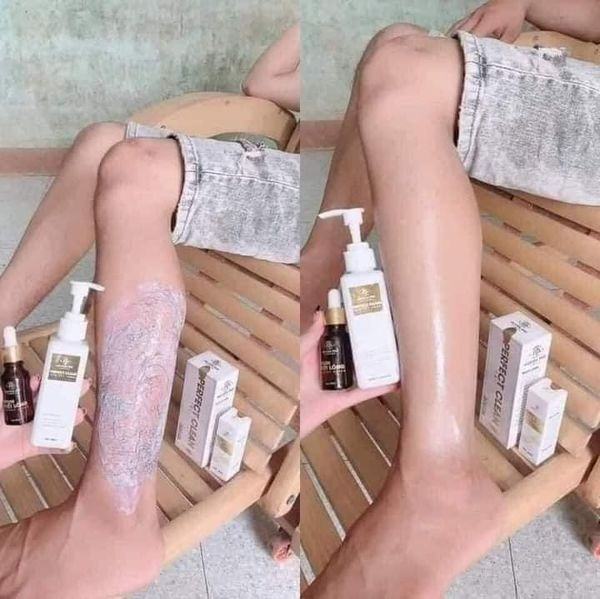 Kem tẩy lông Huyền Phi