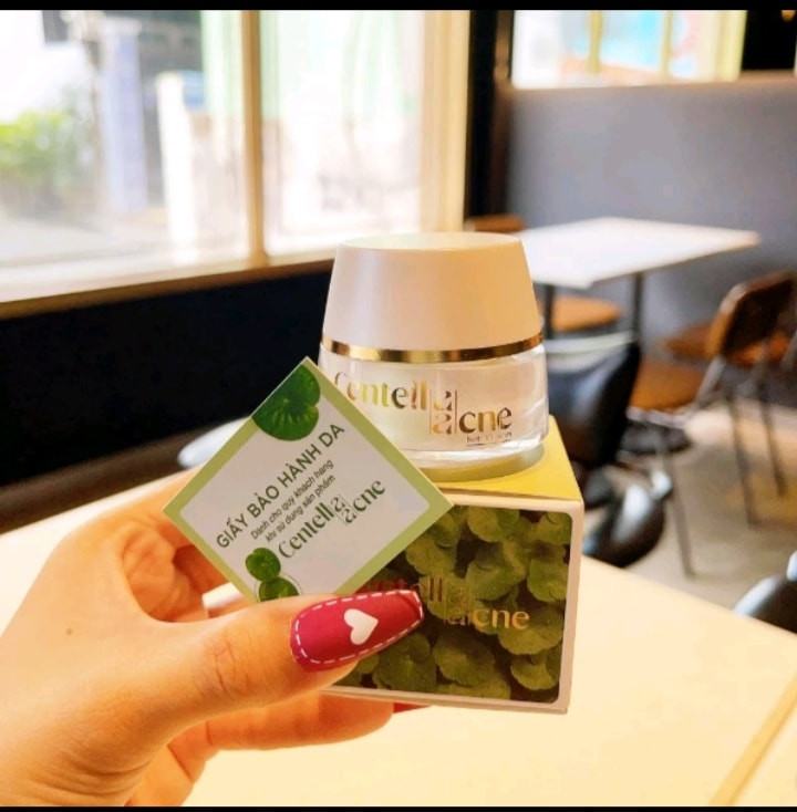 Kem Face Mụn Rau Má Jiuhe Centella Acne Thanh Tô Cosmetics 10g