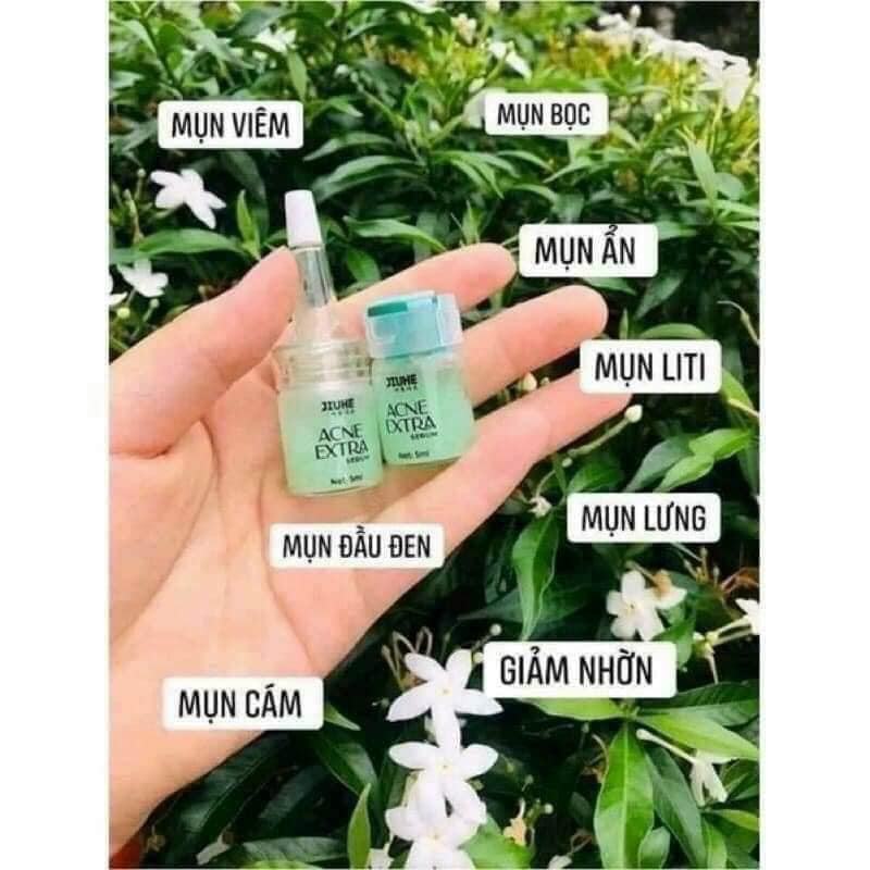 Tại sao tôi khuyên bạn nên dùng Jiuhe Acne Extra để trị mụn