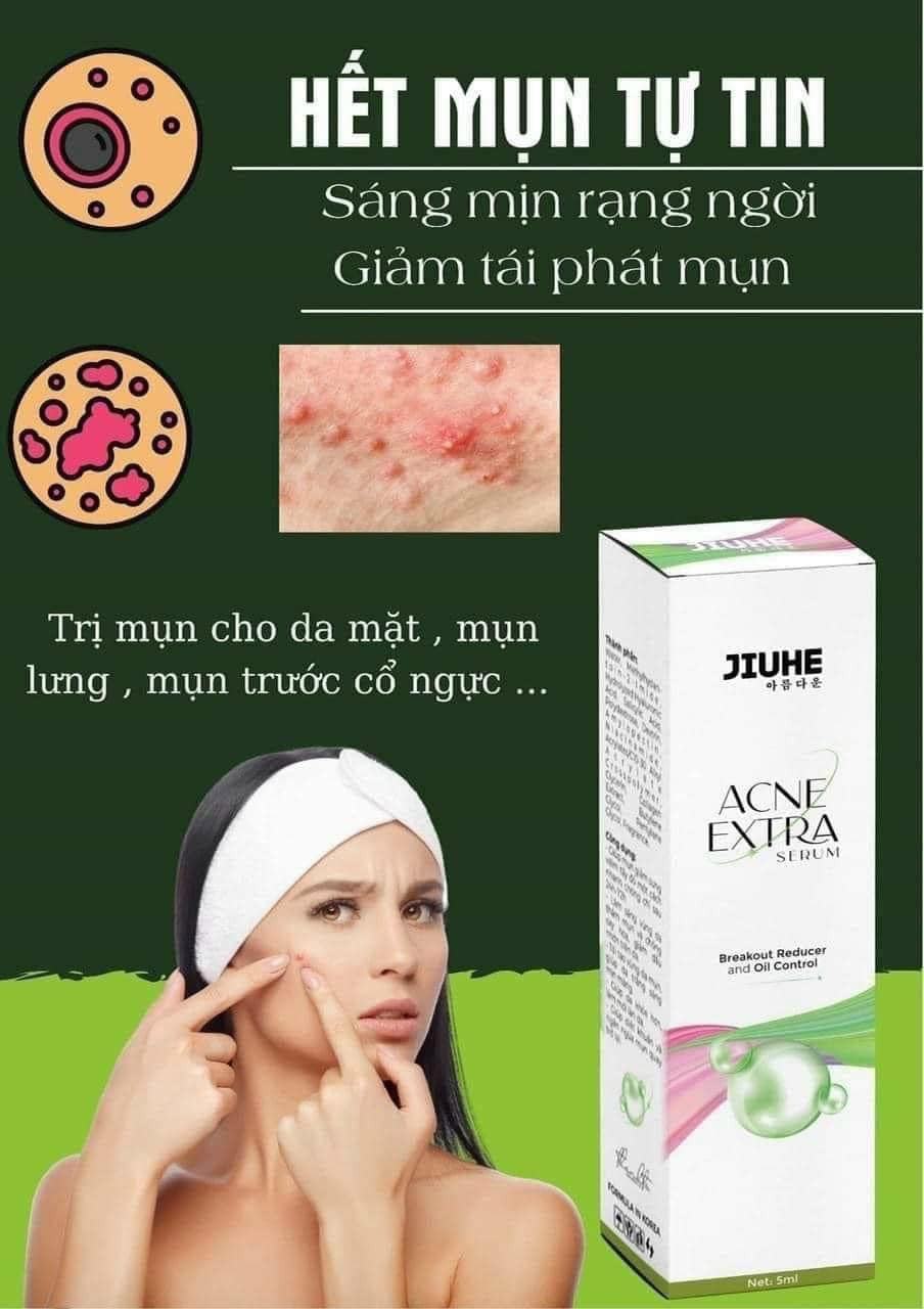Sạch mụn liền tay có ngay Jiuhe Acne Extra