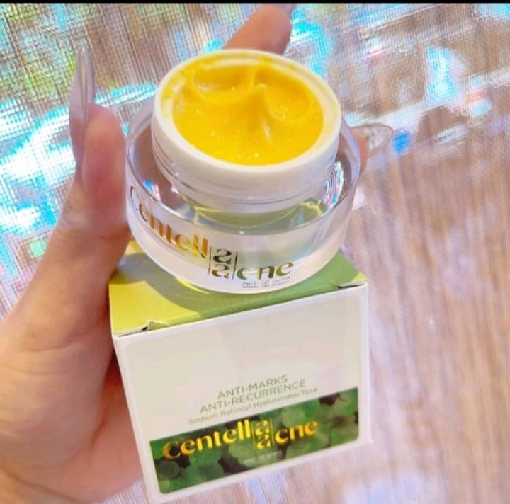 Kem Face Mụn Rau Má Jiuhe Centella Acne Thanh Tô Cosmetics 10g