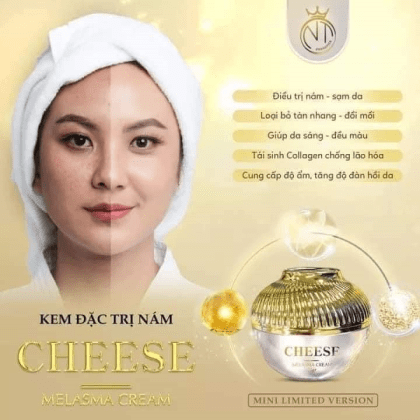 Da đẹp đón Tết xinh cùng Kem Face Nám Melasma Cheese NT Cosmetics