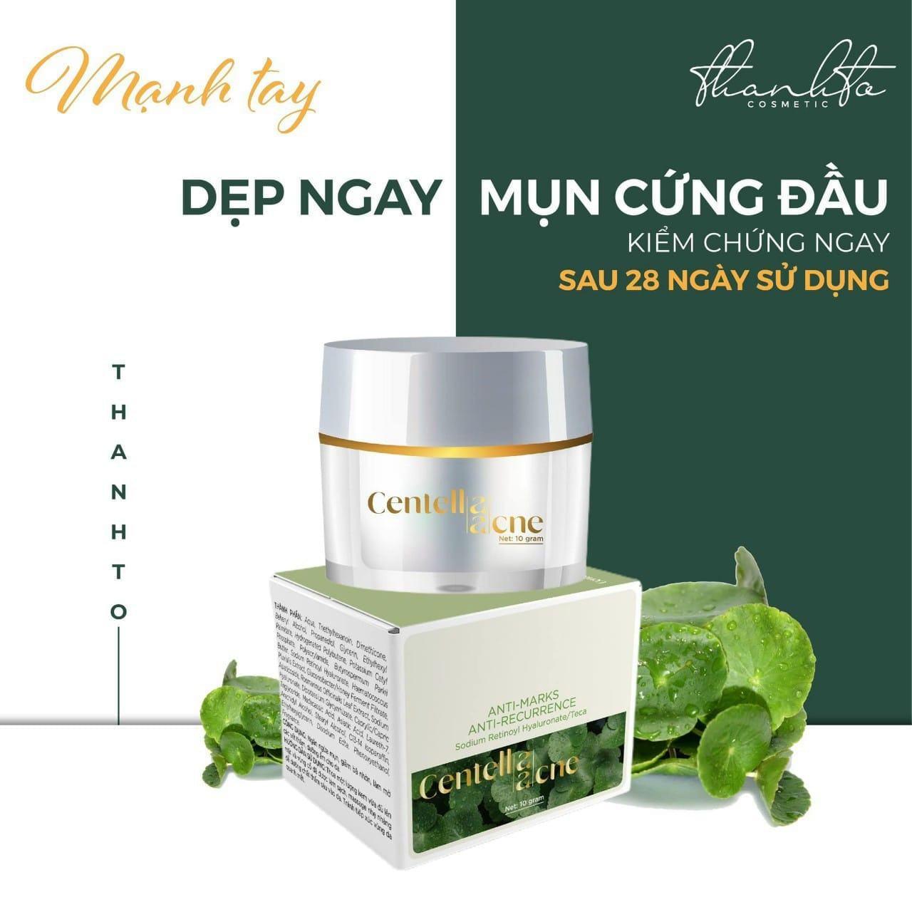 Kem Face Rau Má Thanh Tô Giảm Mụn Jiuhe Centella Acne
