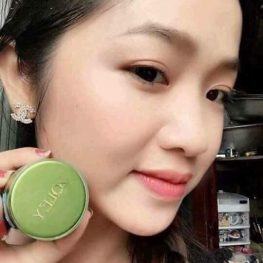 Kem face Zoley xanh trị mụn trắng da