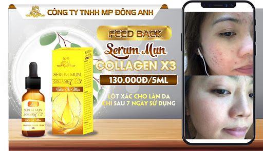 Serum trị mụn Collagen X3 Đông Anh
