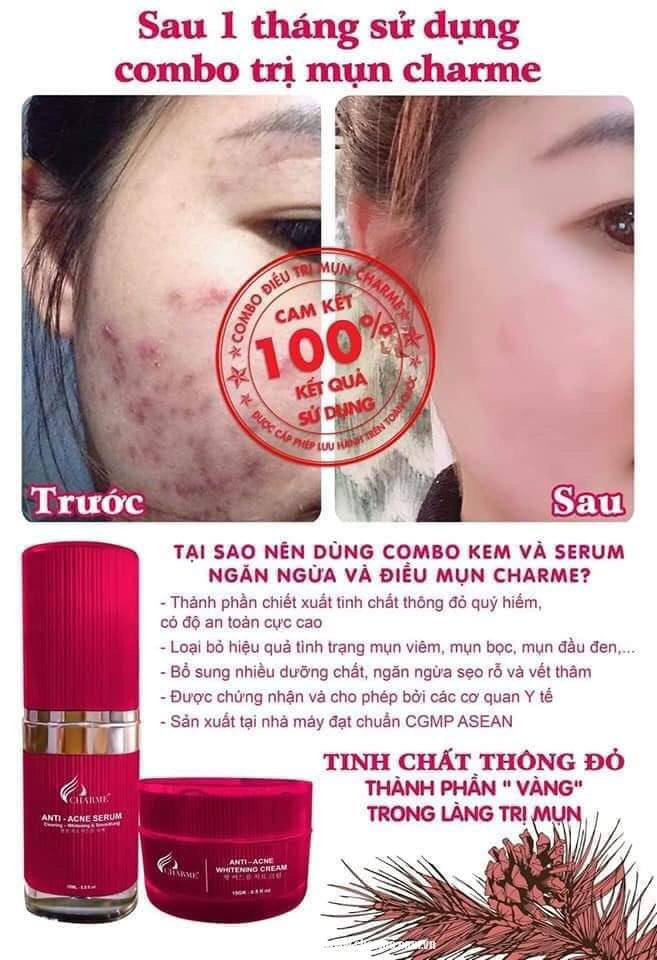 19227-z4294569949526-766be75f00e5ea2fd5e6be4bfc43c98e-4.jpg Serum Mụn Hàn Quốc Charme Anti Acne 15ml - 8809273480227
