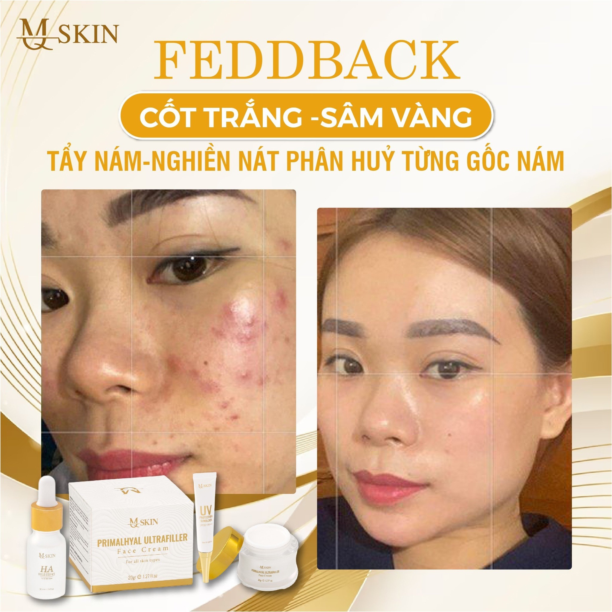 21608-357689205-570342548605925-5308711782493165650-n-4.jpg Combo Kem Face Sâm Vàng MQ Skin - CBFACEMQSKIN01