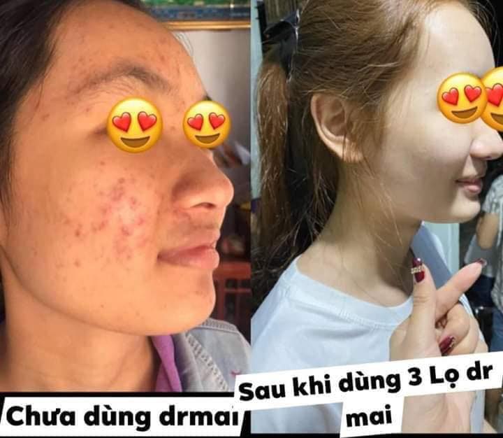DÙNG MỘT LẦN - YÊU MỘT ĐỜI