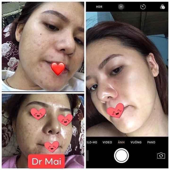 Feedback yêu từ khách dùng Dr. Mai