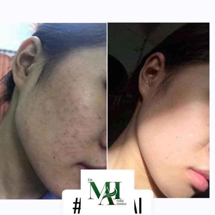 Feedback yêu từ khách dùng Dr. Mai