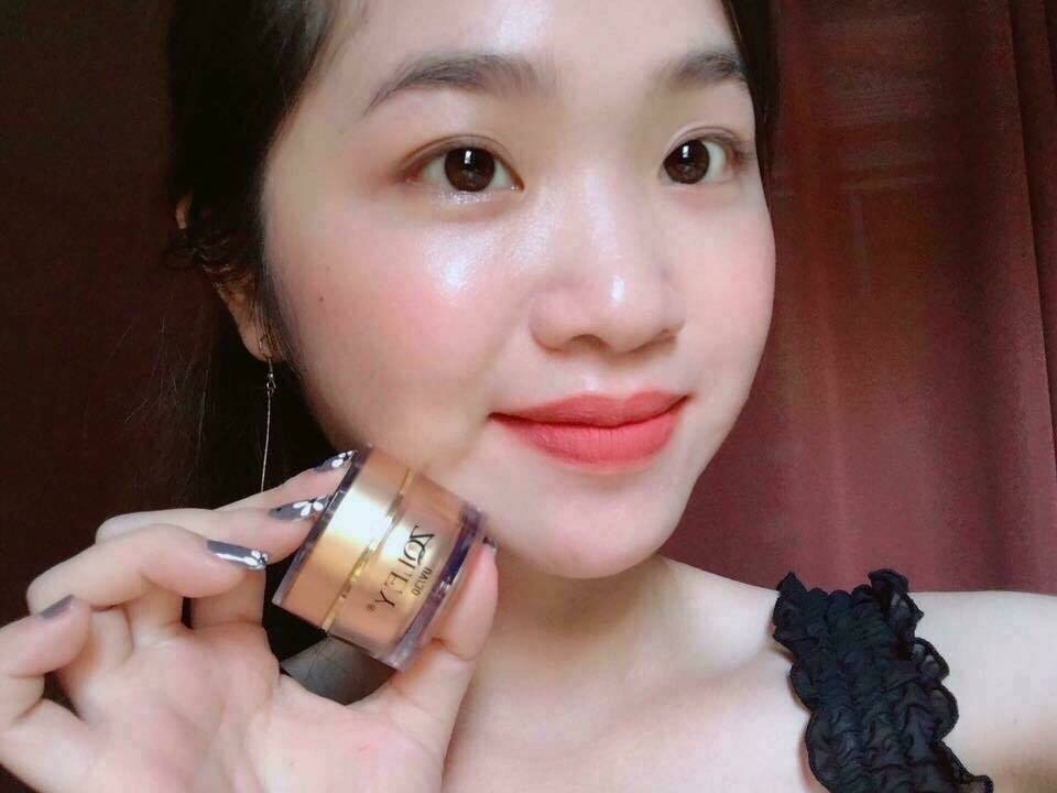 Kem face Zoley vàng chống lão hóa vượt trội