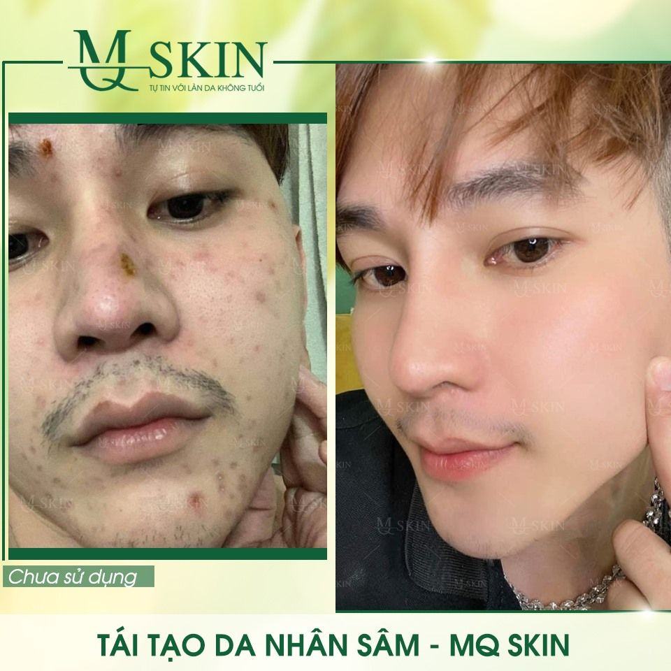 Vì sao "BB Cream tái tạo da MQ Skin" gây siêu bão trên thị trường?