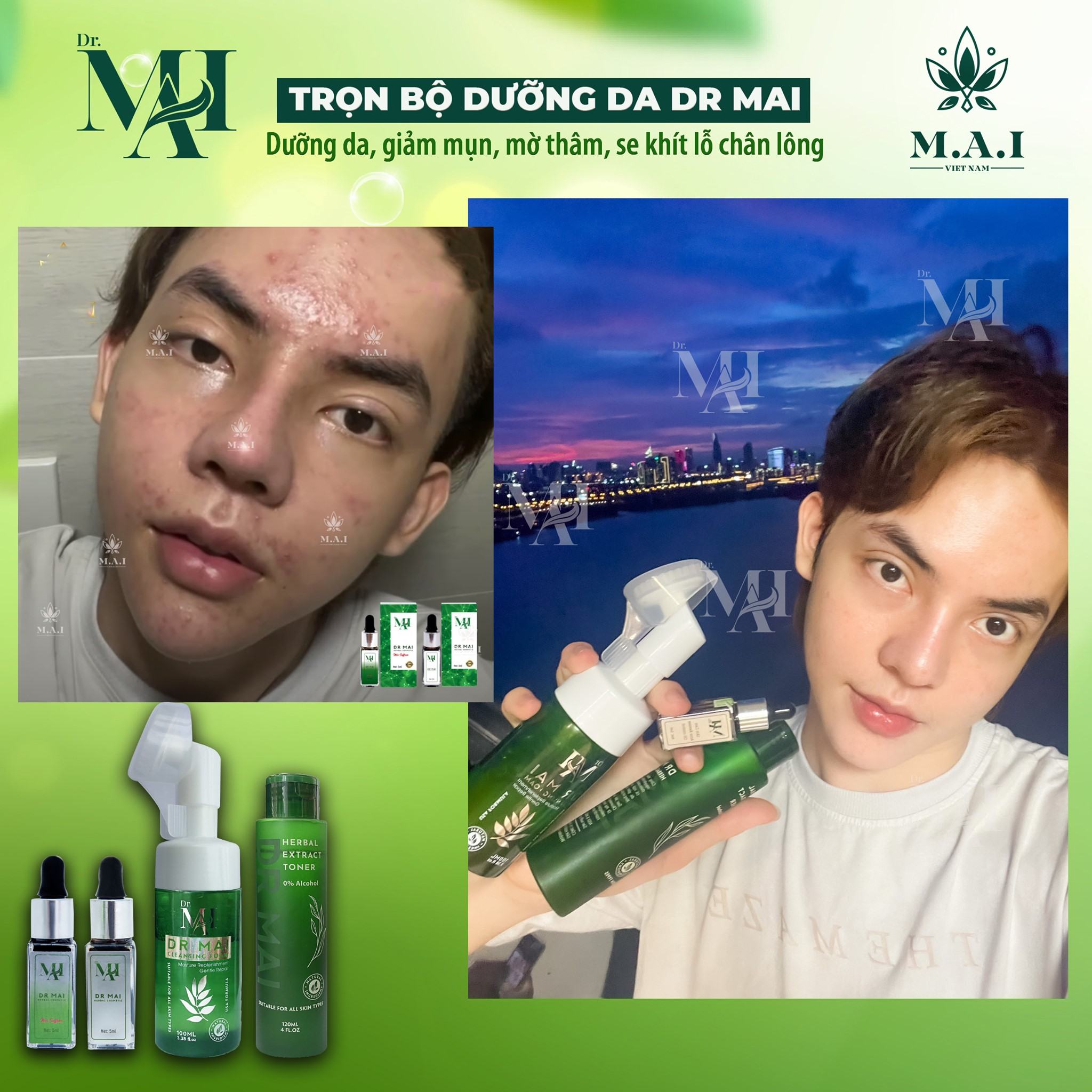 Dr Mai - dưỡng da giảm mụn không bị phụ thuộc