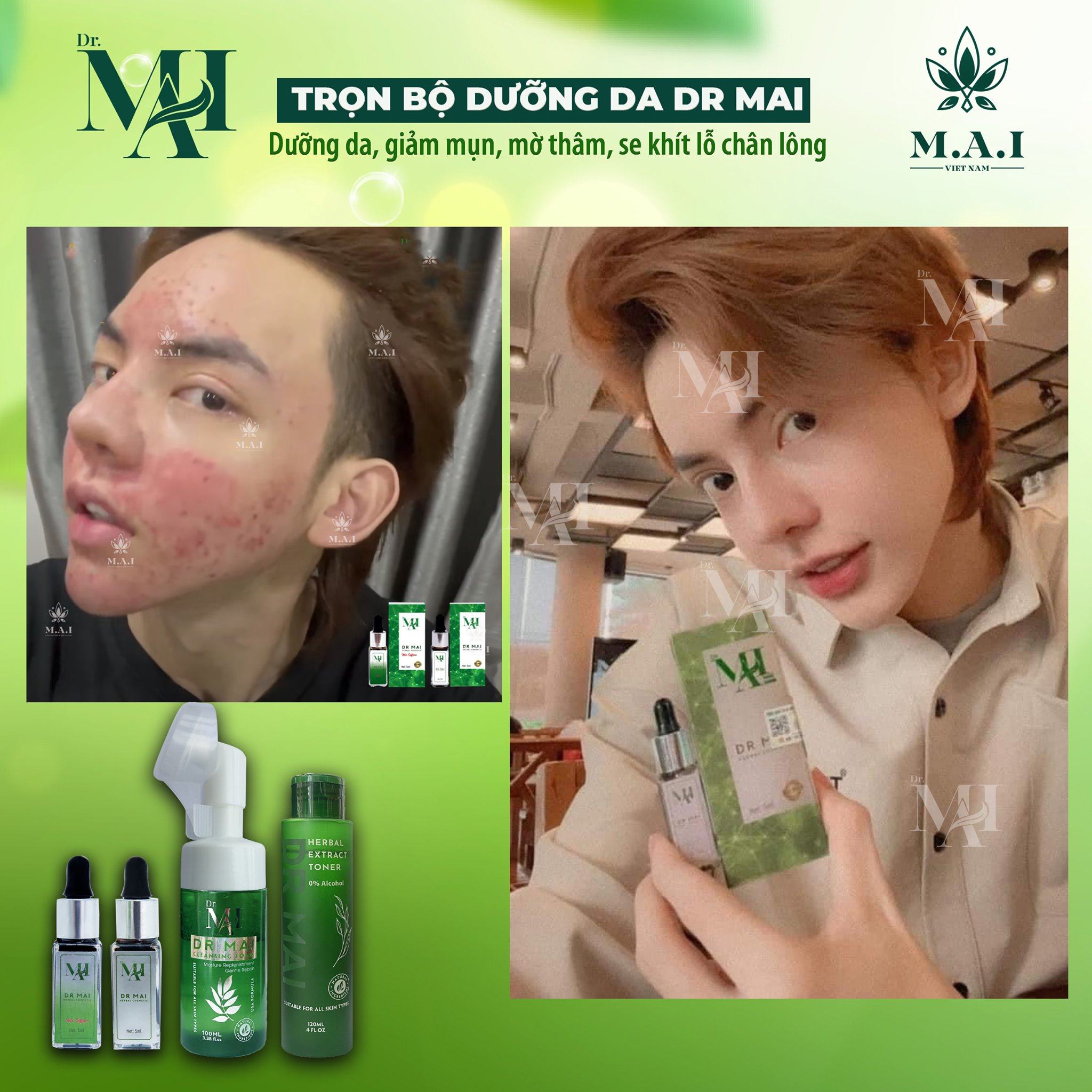 Dr Mai - dưỡng da giảm mụn không bị phụ thuộc