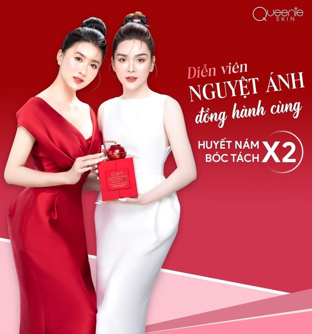 Huyết nám bóc tách x2 xóa bỏ sự tự ti về nám bên trong bạn 8 Huyết nám bóc tách x2 xóa bỏ sự tự ti về nám bên trong bạn