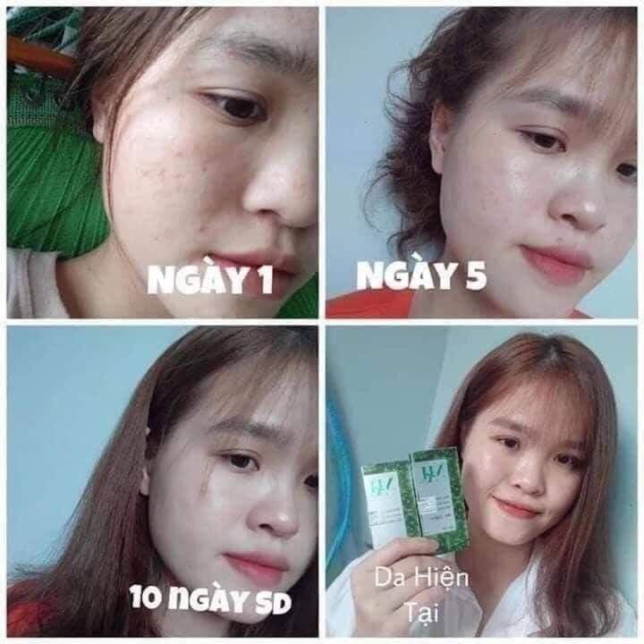 Phía sau 1 làn da đẹp là tôi‼️ Tôi là .... DR Mai🍃