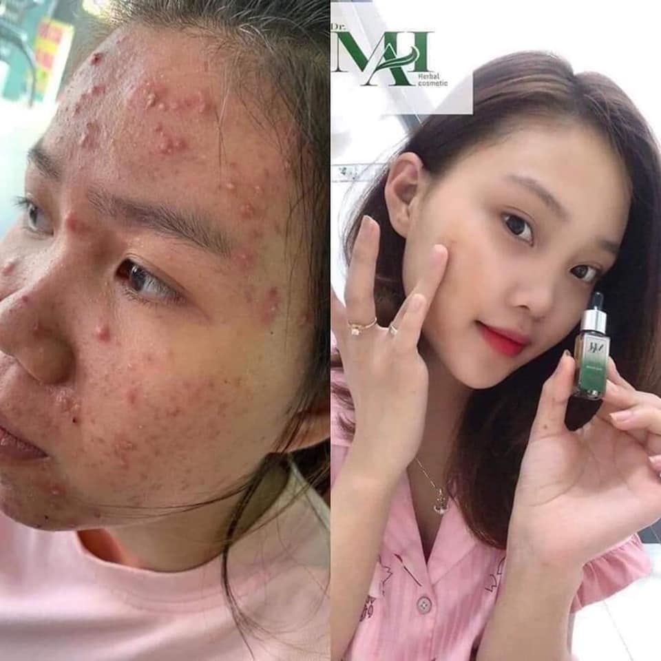 Phía sau 1 làn da đẹp là tôi‼️ Tôi là .... DR Mai🍃