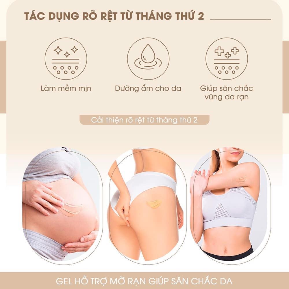 Rạn da trong thai kì không còn là nỗi lo