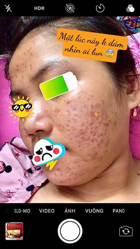 Dr Mai - Có 1 không 2 trên thị trường hiện nay