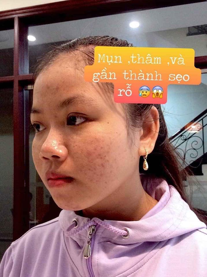 Dr Mai - Có 1 không 2 trên thị trường hiện nay
