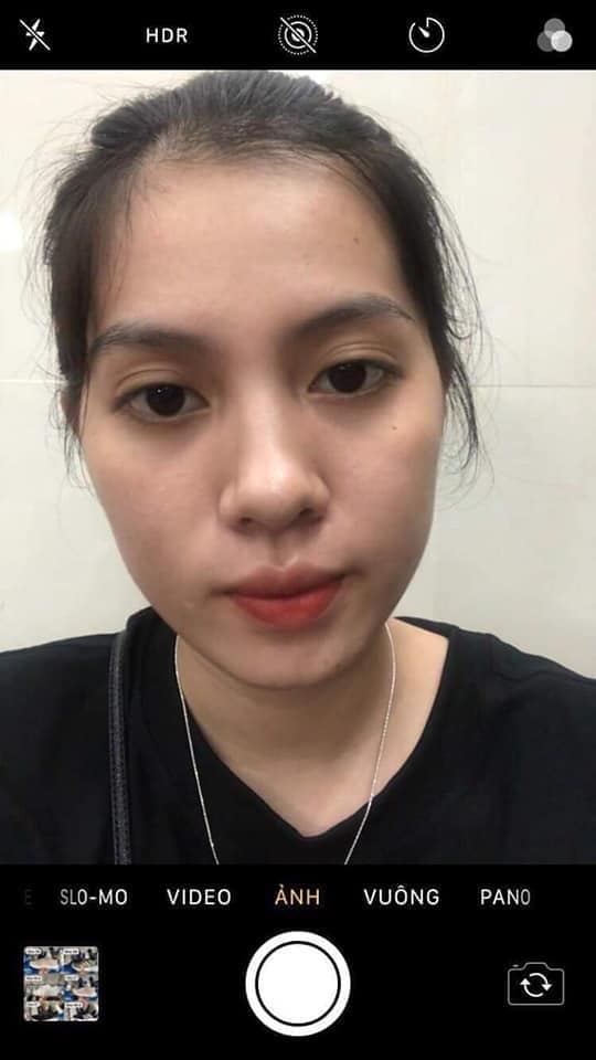 Feedback của chị khách 22 tuổi dùng Dr Mai bên nhà tui