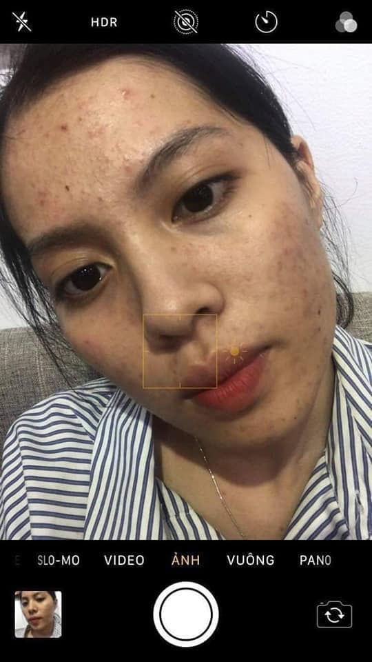 Feedback của chị khách 22 tuổi dùng Dr Mai bên nhà tui