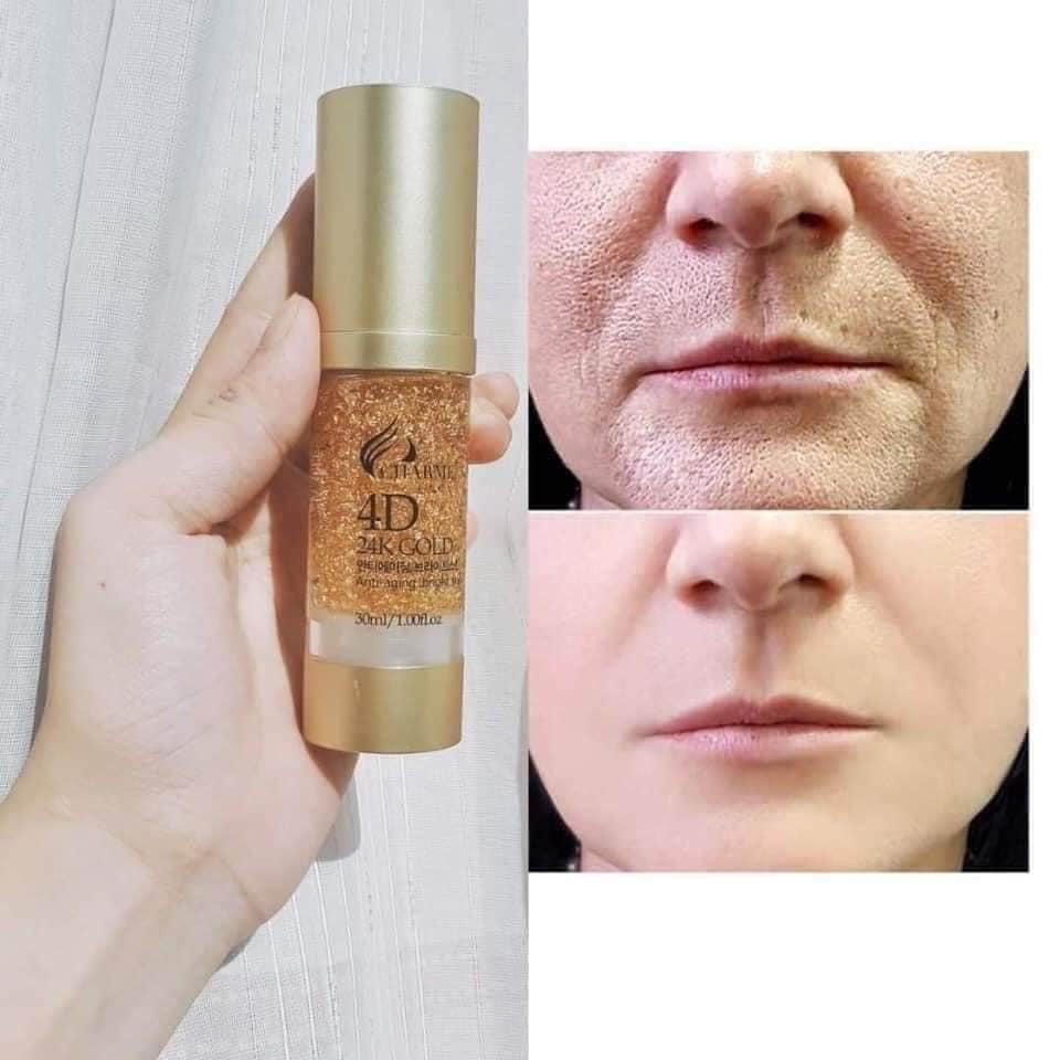 Charme Serum vàng 24k Gold Sản phẩm đang hot hiện nay
