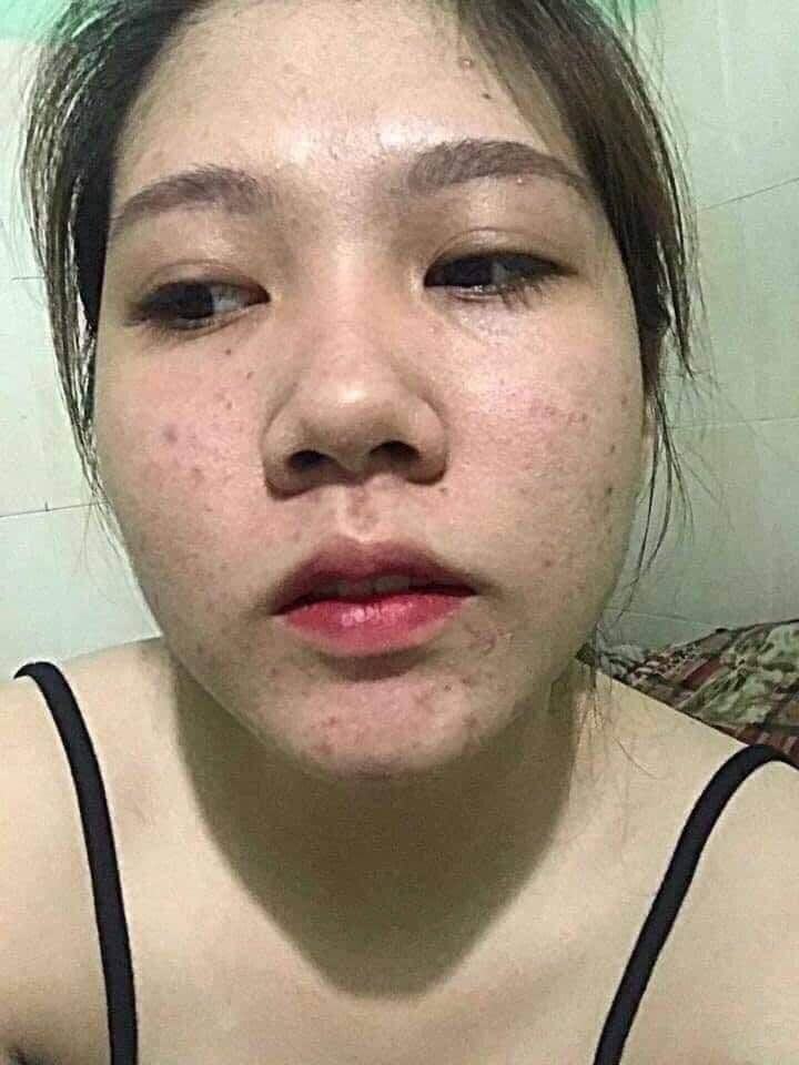 Dr Mai - thấu hiểu làn da việt